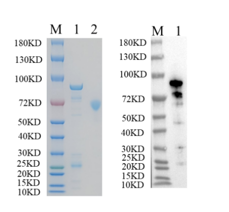 Reducing 12% SDS-PAGE (CBB stained) and WB (Anti-His Mouse Monoclonal Antibody) analysis profiles of purified RFL15898LF.
1. RFL15898LF: 1 μg
2. BSA: 1 μg